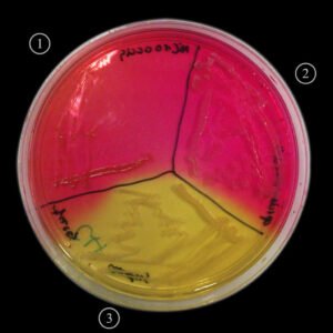 Mannitol Salt Agar Medium for Staphylococci Isolation