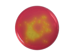 Mannitol Salt Phenol Red Agar for Staphylococcus aureus Isolation, Food Testing, Laboratory Use