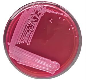 MacConkey Agar medium in petri dish showing red colonies.