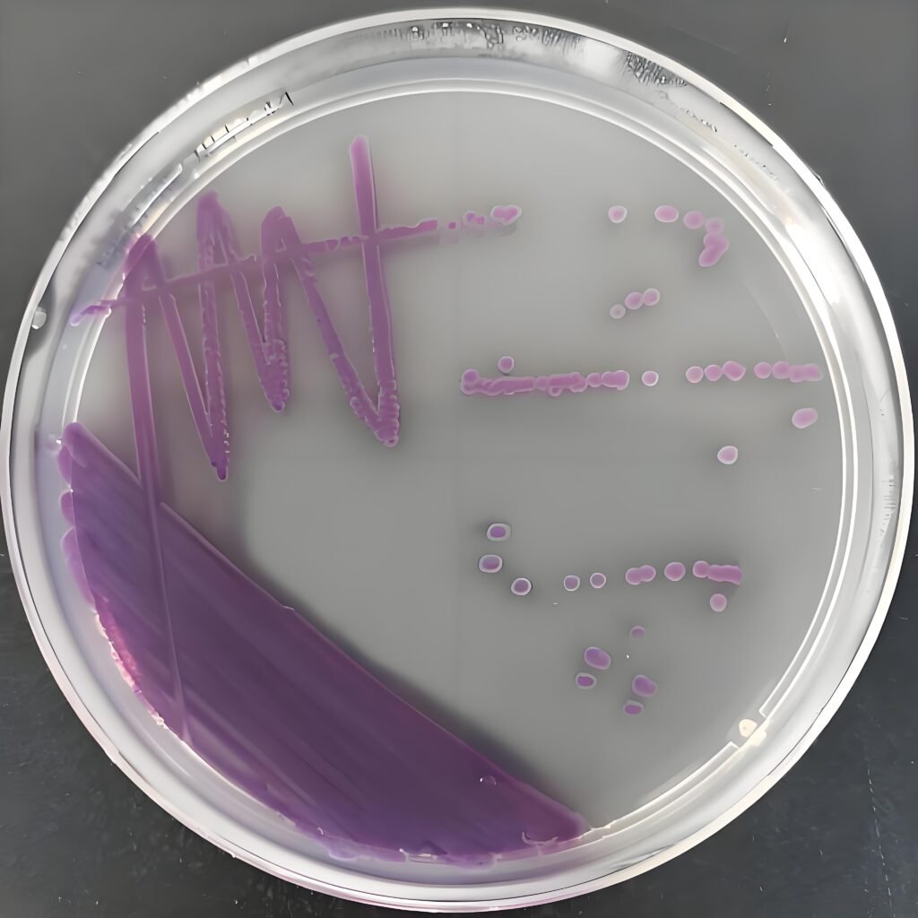 chromogenic media work in identifying pathogens